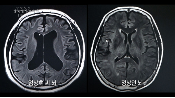 [사진= KBS 1TV '생로병사의 비밀' 제공]